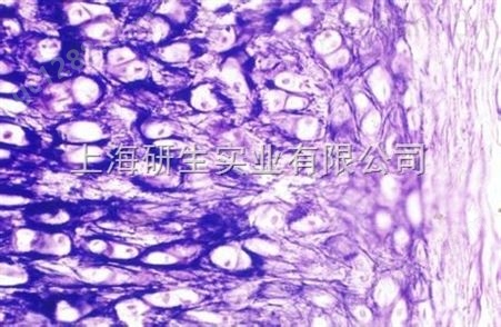 小鼠抗人IgA杂交瘤细胞；mAbhIgA-492培养